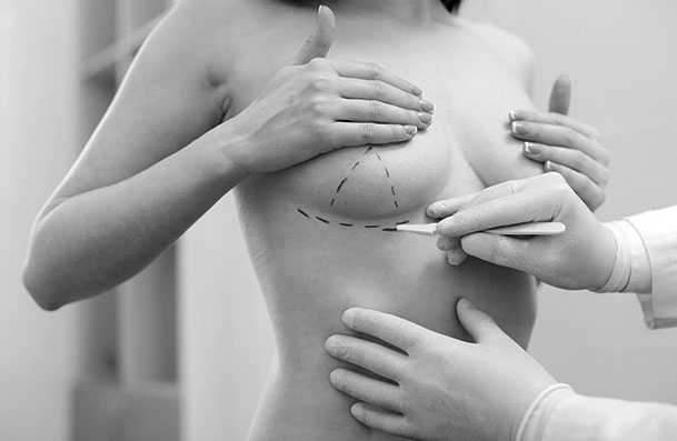 Chirurgie mammaire à Lille et Arras - Dr Fevrier